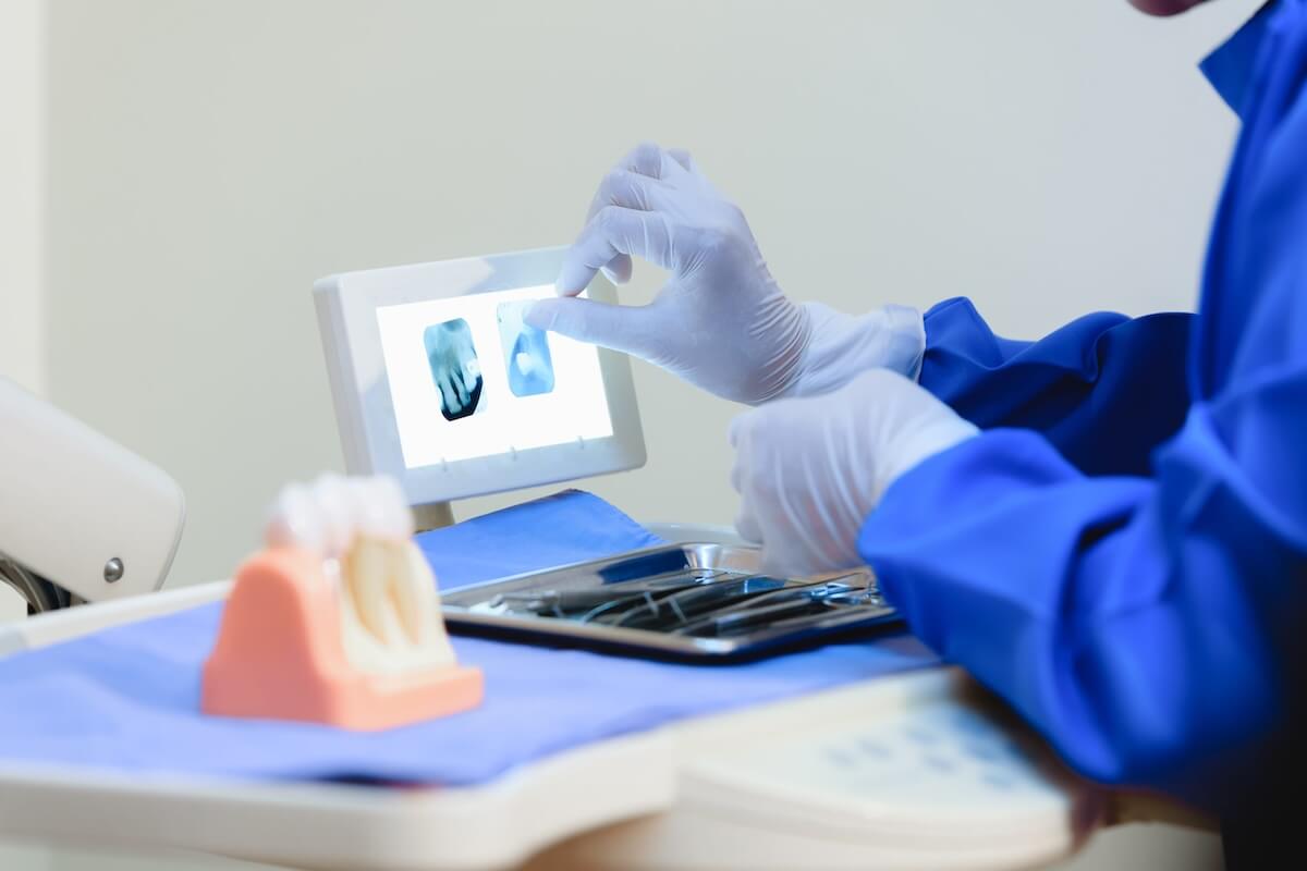 Gloved dental professional touching a small monitor displaying digital teeth X-rays next to clinical tools.